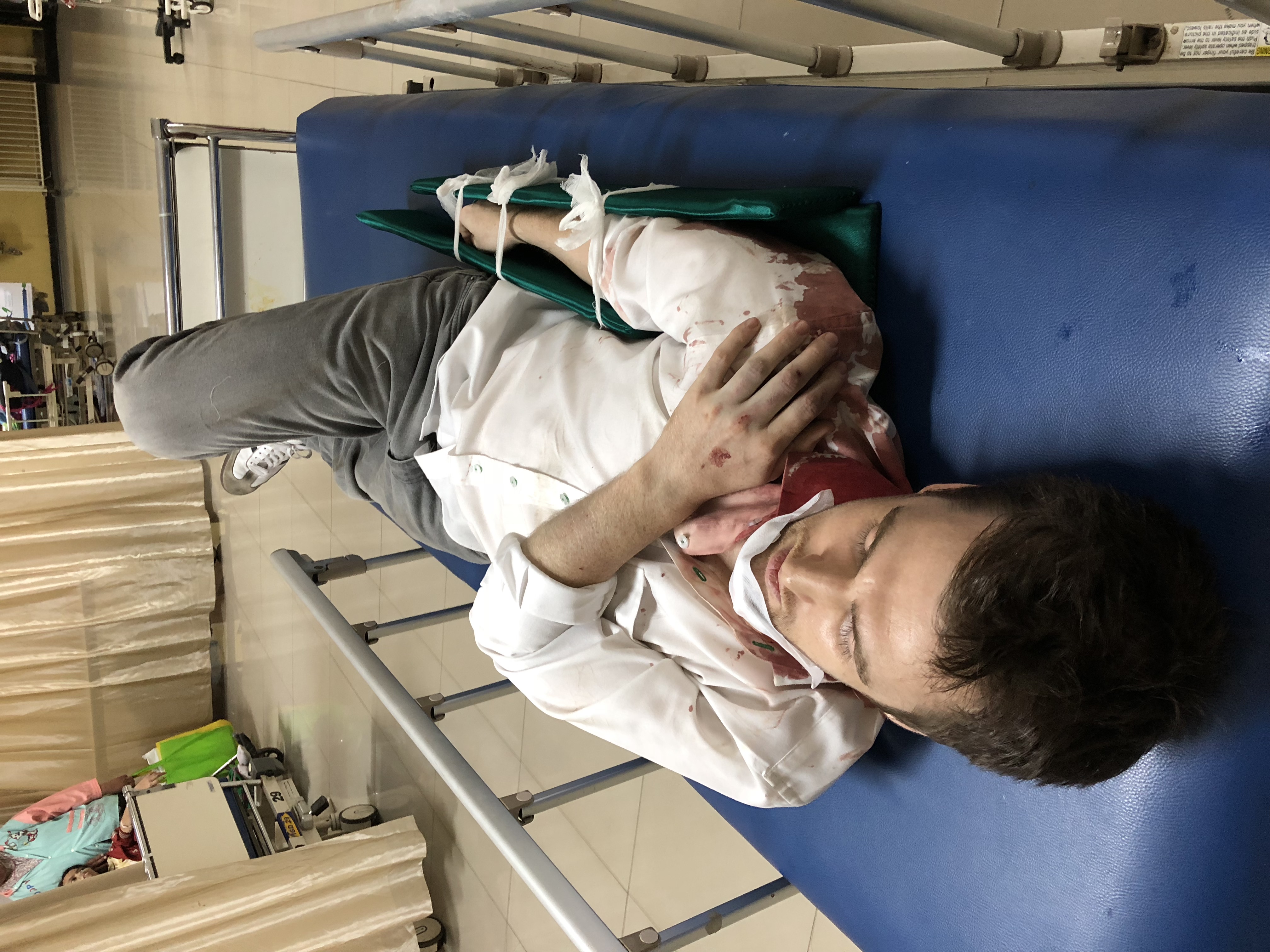 The immediate aftermath, right arm immobilized The immediate aftermath, right arm immobilized